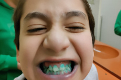 2025-AO8-Zahnputz-Training-1